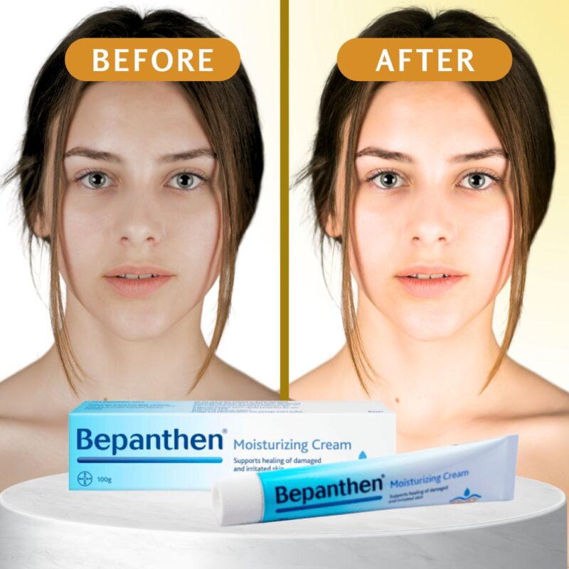 Bepanthen Skin Moisturizer, Moisturizes and cares for dry skin,100g - Image 2