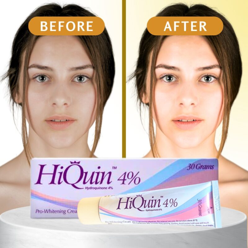 Hi Quin 4% Lightening Cream - Image 2