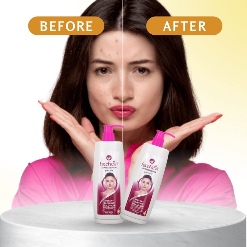 ORIGINAL Face Fresh Fairness Lotion - Image 2