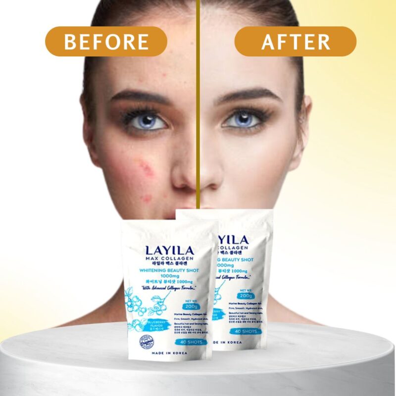 LAYILA Blubbery Collagen 1000 mg - Image 2