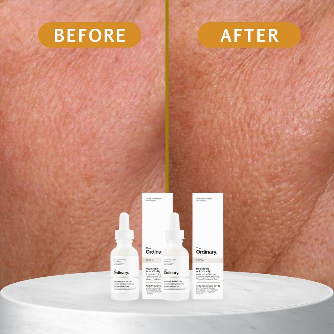 ORIGINAL Ordinary SUPERSIZE Hyaluronic Acid 2% + B5 - Image 3