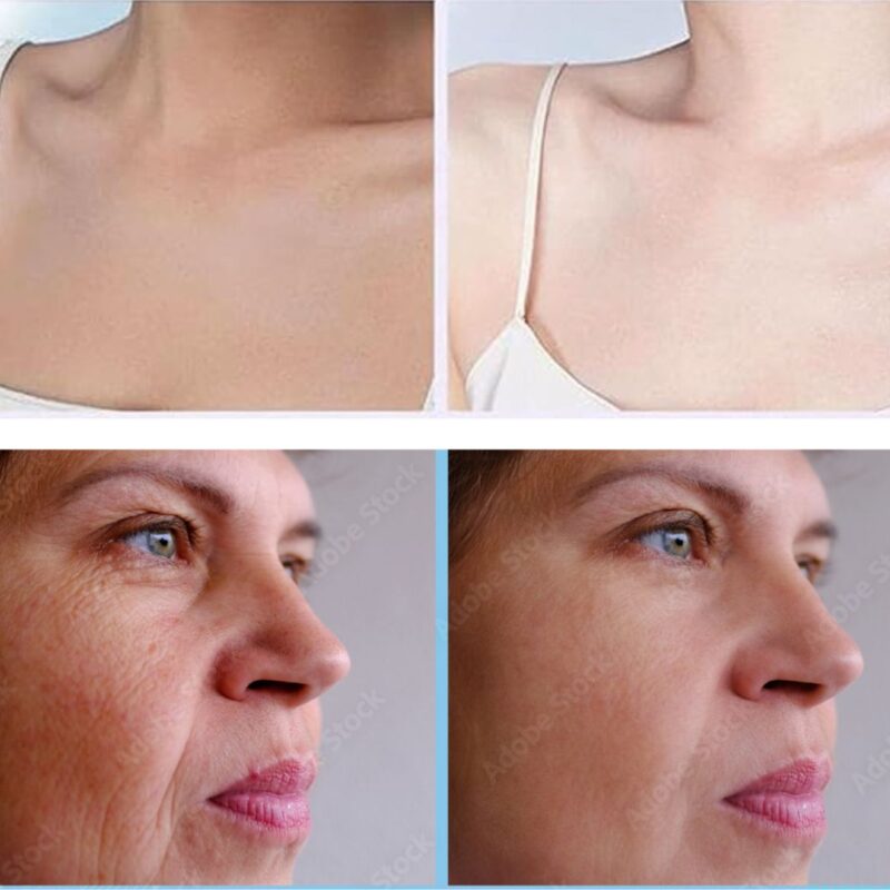 ORIGINAL Face fresh fairness full set - Image 3