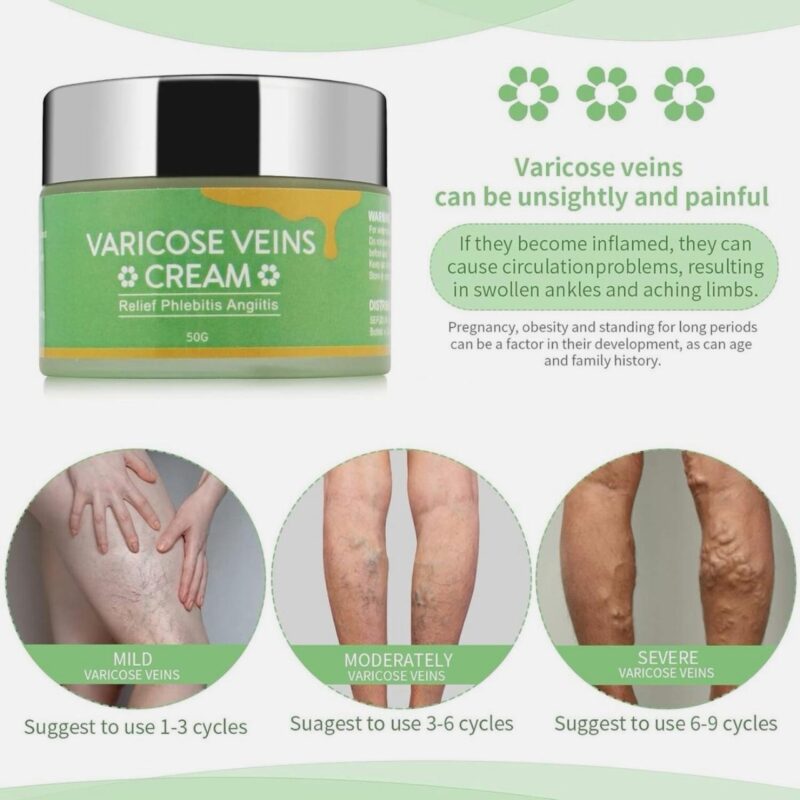 CremePure Varicose Veins Cream - Image 3